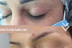 resultat-detatouage-tunisie-sourcils4587hrl